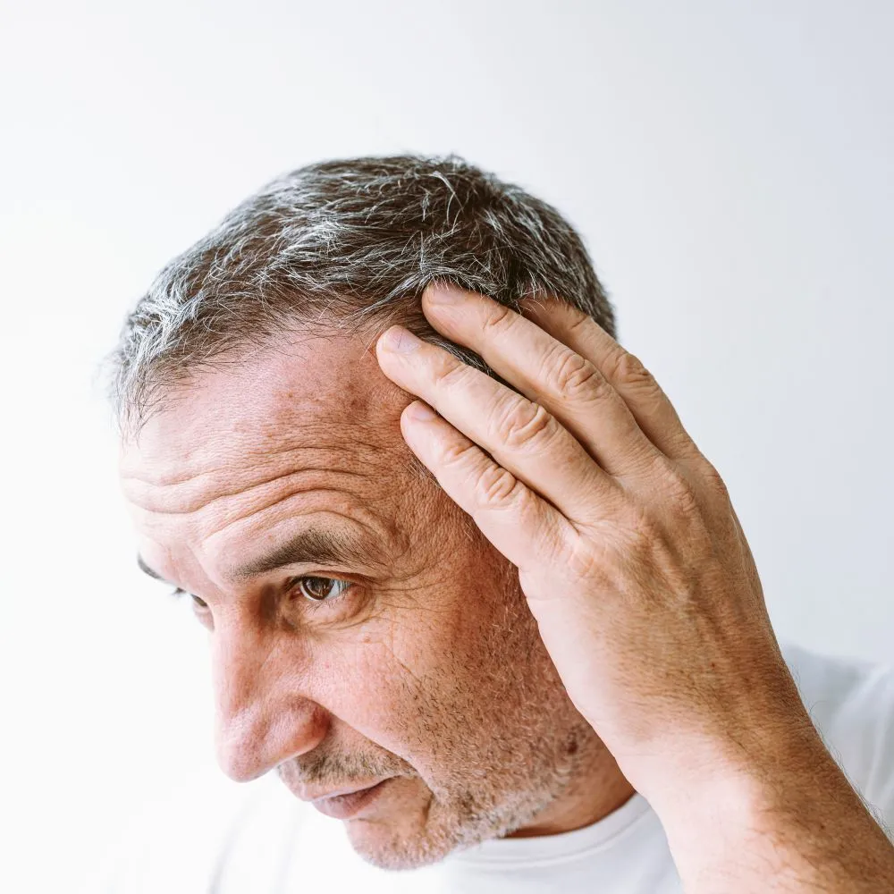 Hair Thinning