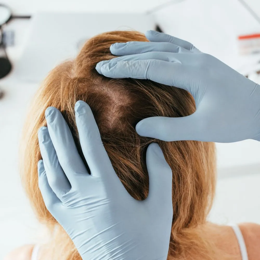 Understand Hair Changes